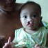 helping-children-suffering-from-cleft-lip-1